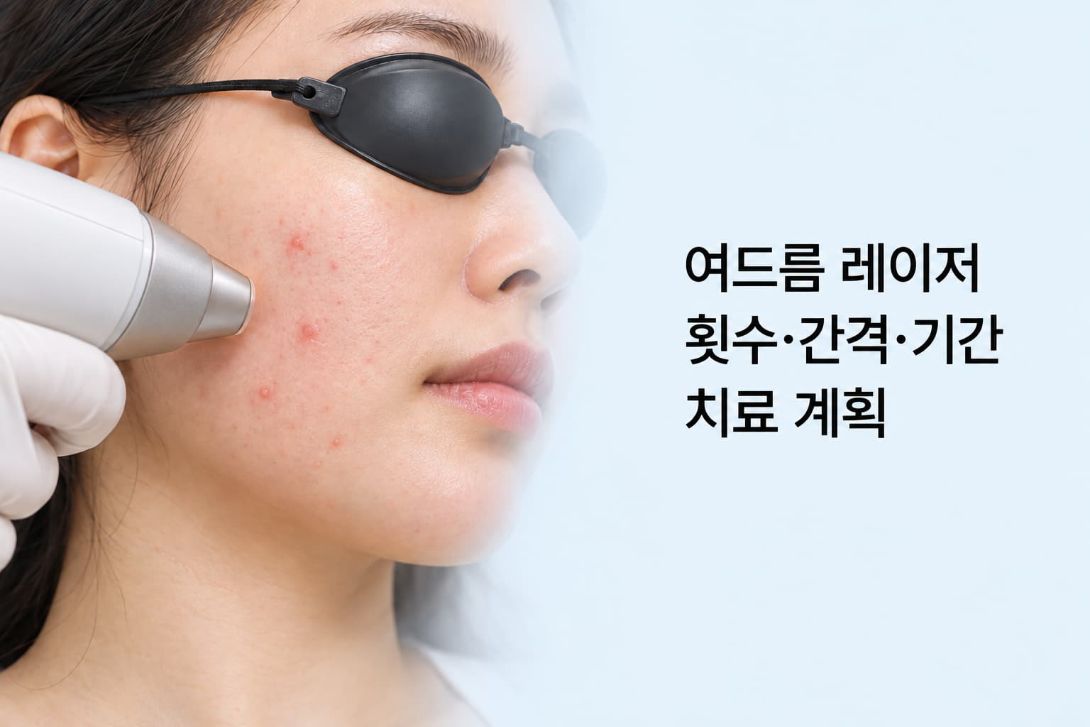 여드름이 있는 볼 피부에 레이저를 시술하며 치료 횟수와 간격을 안내하는 장면