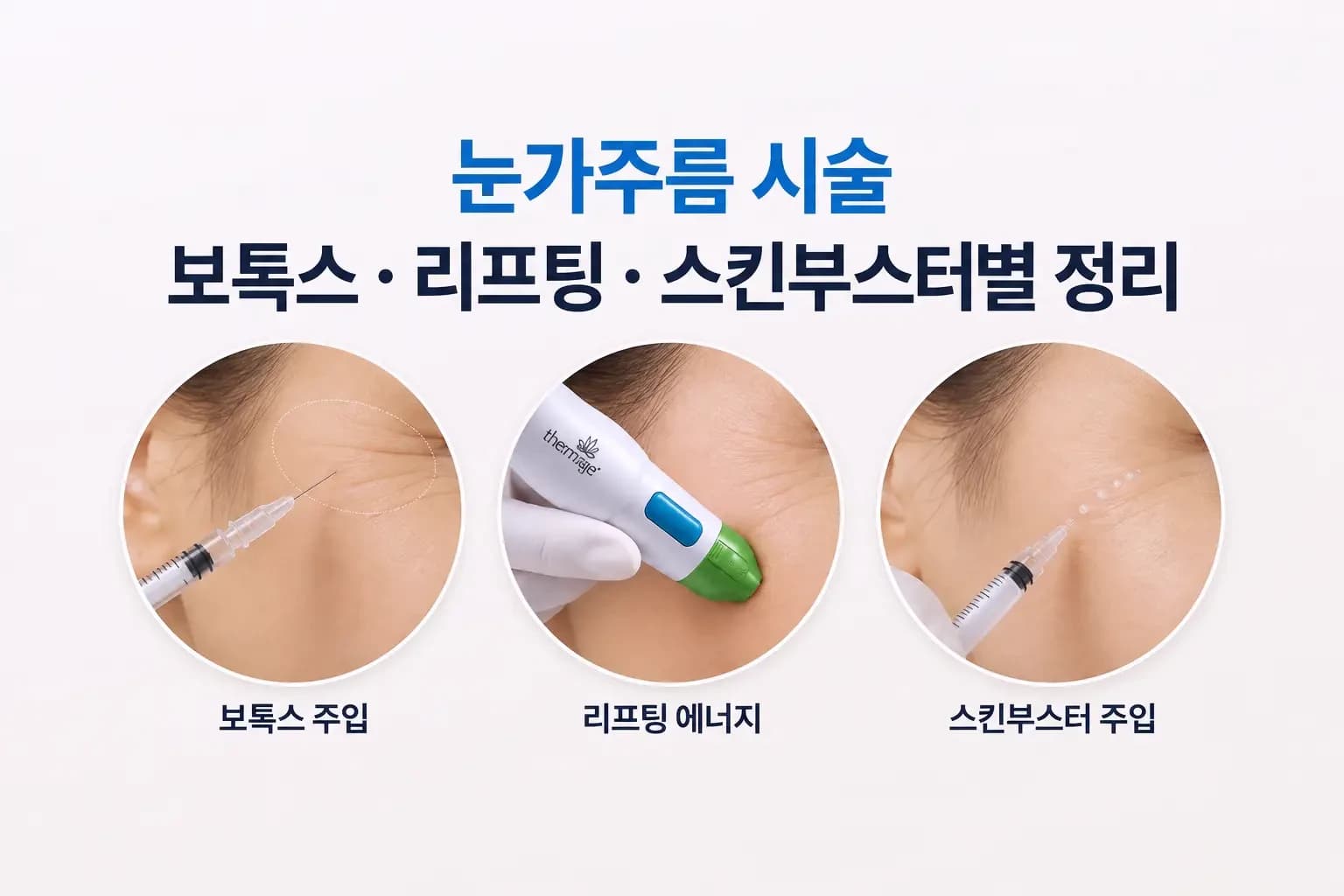 눈가주름 시술 종류별 비교 이미지, 눈가 보톡스 주입과 리프팅 에너지 장비 시술, 스킨부스터