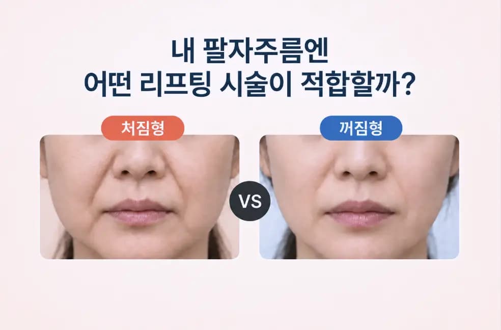 처짐형과 볼륨부족형 팔자주름의 볼 형태 차이를 좌우로 비교한 팔자주름 리프팅 기준 썸네일