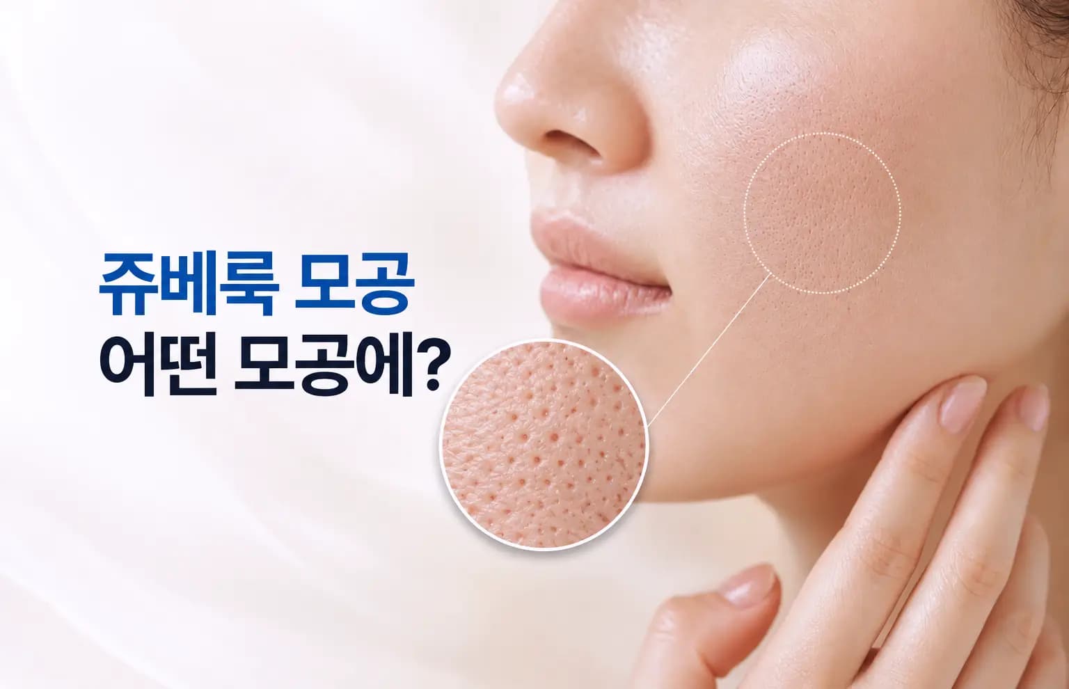 볼 피부 모공과 PDLLA 입자가 진피 콜라겐을 받치는 확대 컷을 담은 쥬베룩 모공 썸네일